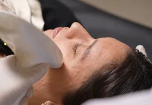 luxeria Scar Free for Acne Scars at Luxeria Clinic