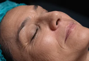 Anti-wrinkle skin rejuvenation session at Luxeria Clinic
