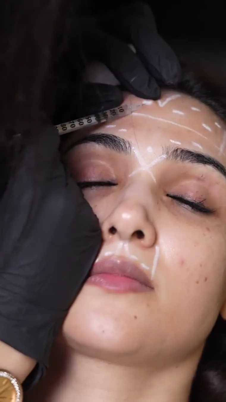 Doctor consultation before Botox treatment at Luxeria Clinic