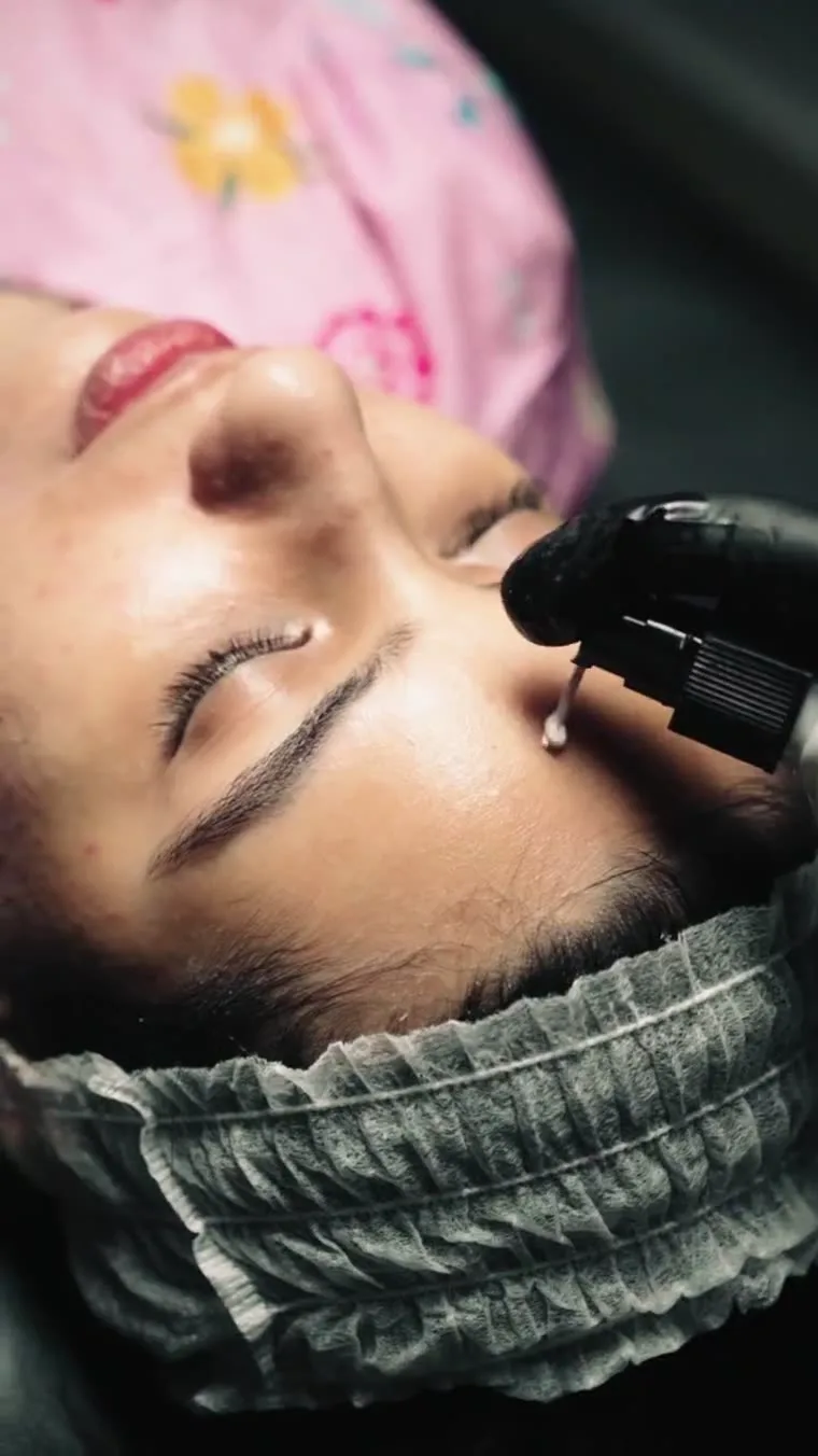 Medical-grade peel application at Luxeria Clinic