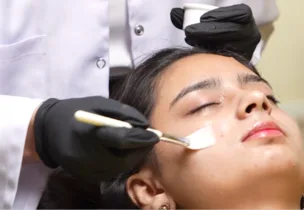 Party Peel at Luxeria Clinic