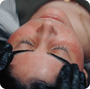 Scalp detox deep-cleansing treatment at Luxeria Clinic