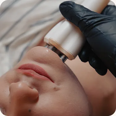 Gummy smile correction at Luxeria Clinic
