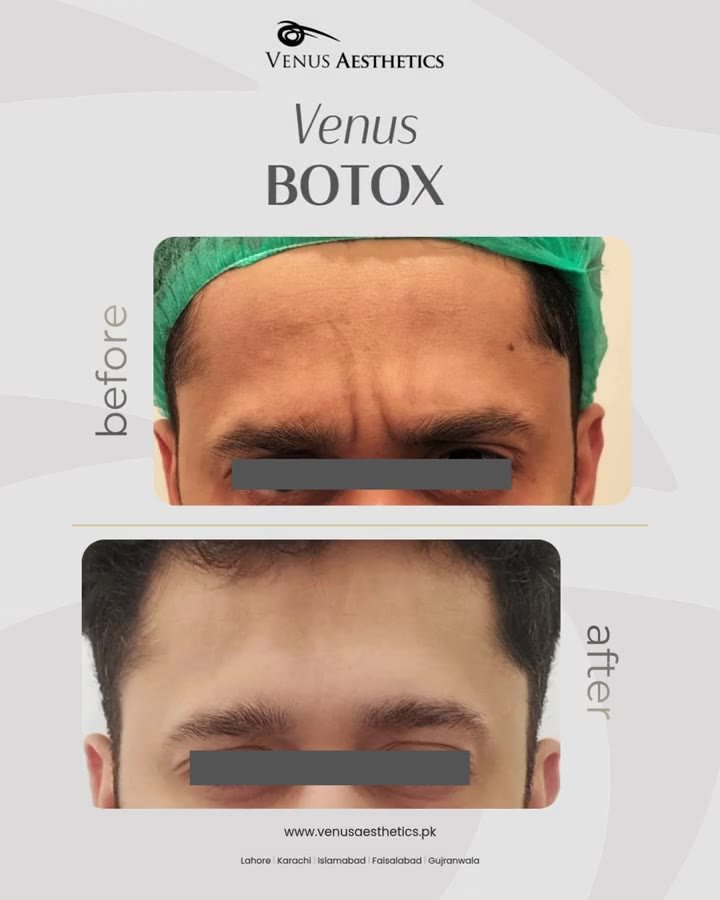 Treatment illustration